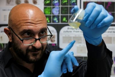 'Synthetic embryo' breakthrough but growing human organs far off