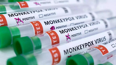 Monkeypox test run on 17 samples in Maharashtra, no positive case so far