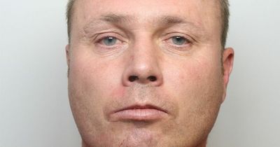 Man burnt girlfriend with cigarette, stamped on her face and broke her jaw