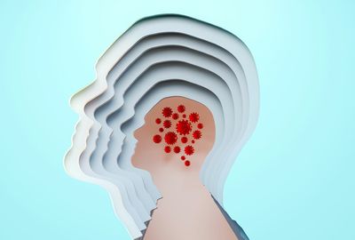 Cognitive rehab to treat COVID brain fog