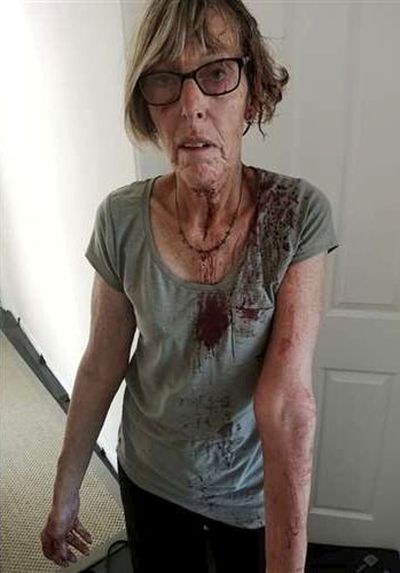 Vicious seagull attack leaves grandmother looking like ‘something from Freddy Krueger film’