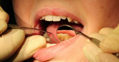 Desperate Brits sticking teeth to gums with glue as 91% of NHS dentists snub new patients