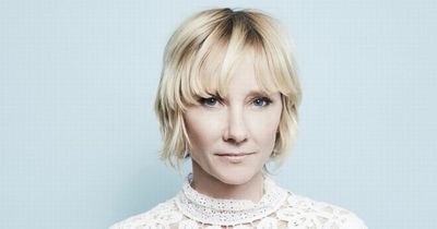 Anne Heche in critical condition in a coma with lung damage and burns after horror crash