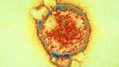 Novel Langya virus tracked in China after reports of 35 cases. This is what scientists know so far