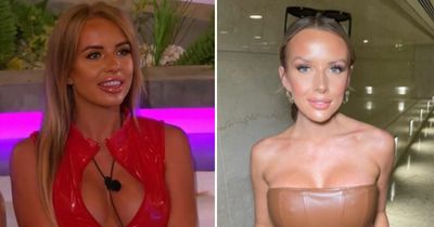 Faye Winter’s changing face as MasterChef star ditches lip filler after Love Island