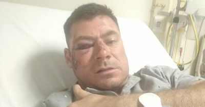 Tonight's rugby news as ex-Springbok hospitalised after alleged assault and Welsh region clarify situation