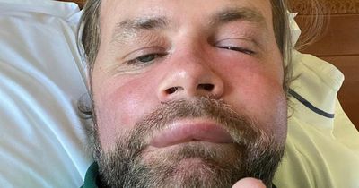 Brian McFadden fans rush to support singer after he shares brutal reaction to bee sting
