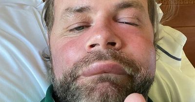 Brian McFadden rushed to doctor by pal Brian Ormond after shocking allergic reaction