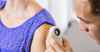 Skin cancer signs: What symptoms to look out for and when to see your GP