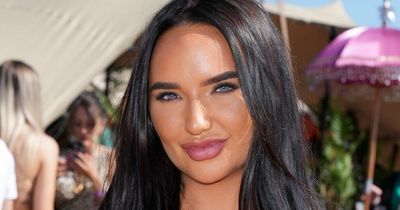 Love Island's Jazmine shares update after hospital dash over life-threatening illness