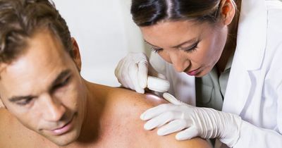 How to spot the symptoms of deadly form of skin cancer - squamous cell carcinoma