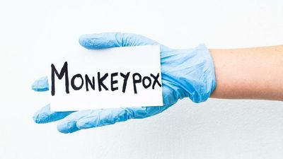 Health: WHO gives new names to monkeypox variants