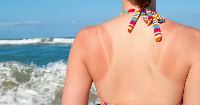 Pharmacist shares sunburn remedies you have in your fridge - from cucumber to yoghurt