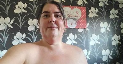 Flesh-eating infection sees woman lose 'half her bum cheek'