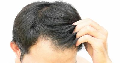 Hair-loss water trick that could help prevent baldness caused by heatwave temperatures