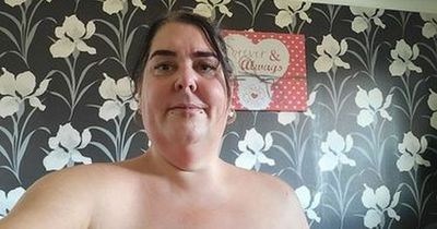 Flesh-eating infection sees woman lose 'half her bum cheek' after routine operation