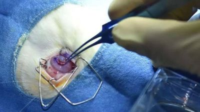 Hyderabad scientists develop India's first 3D-printed cornea