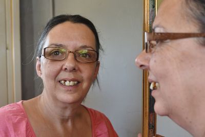 Three Time’s A Charm For Desperate Woman Who Pulled Her Teeth