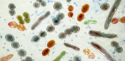 Which microbes live in your gut? A microbiologist tries at-home test kits to see what they reveal about the microbiome