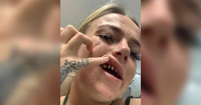 Mum with 'wheelie bin teeth' spotted on TikTok and flown straight to Turkey