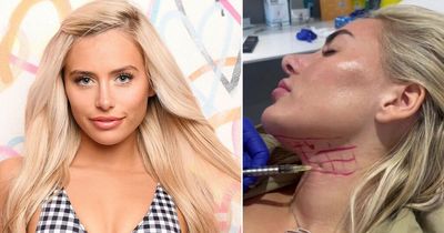 Love Island star looks very different in transformation after neck fat dissolved