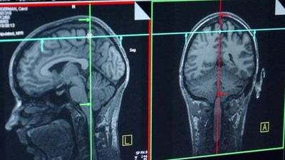 Lawyers could have chips implanted in their brain to cut costs