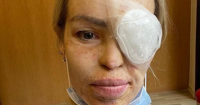 Katie Piper rushed to hospital for emergency op after husband notices black spot in eye