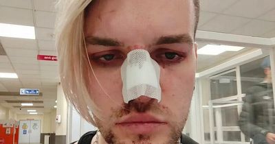 Man beaten by homophobic thugs on bus after standing up when they called him 'freak'