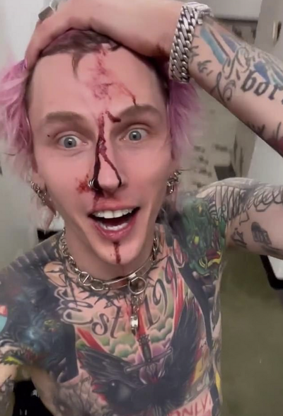 Machine Gun Kelly shares image of his bloody face after he smashes another glass on himself