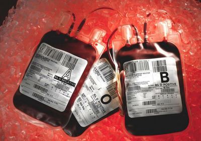 Scottish infected blood victims welcome payout as 'pivotal step'