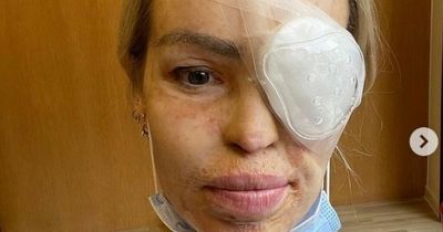 Loose Women star Katie Piper thanks 'amazing' surgical team after emergency op on eye