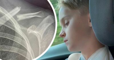 Eight-year-old left 'screaming in agony' with broken bone at summer holiday playscheme