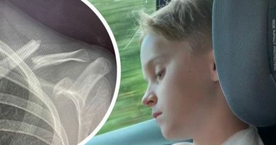 Boy, 8, left 'screaming in agony' after breaking collarbone at kid's play scheme