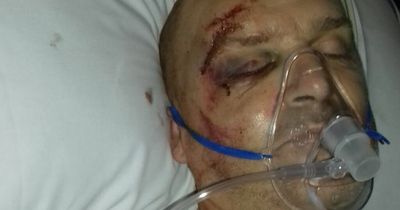 Newcastle man suffered catastrophic injuries in horror crash after his motorbike landed on him