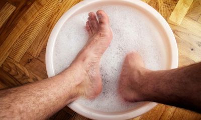 I’m 35 and I have gout – and it’s not for the reasons you think