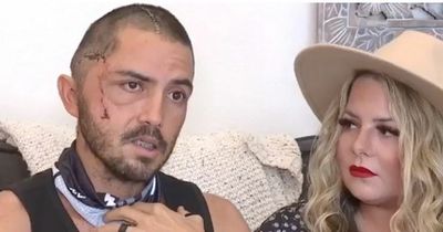 Triathlete's incredible survival after 12ft alligator chomps on his head while swimming