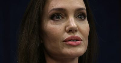 Pictures of Angelina Jolie's bruises after alleged Brad Pitt 2016 fight revealed