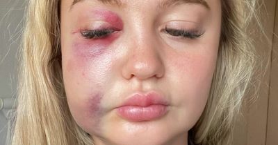 West Lothian woman ambushed at Hot Dub Time Machine by gang who mistook her identity