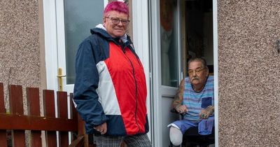 Scots pensioner's ‘terrible homecoming’ after legs amputated as family left in despair