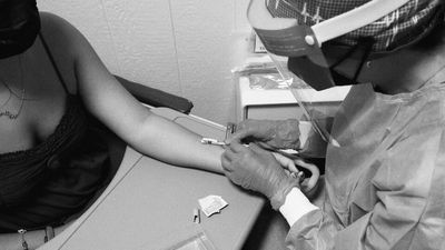 A Risky Monkeypox Vaccine Is Looking Better All the Time