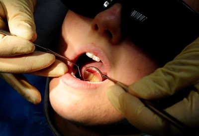 NHS dentistry on its ‘last legs’ despite data showing surge in treatments