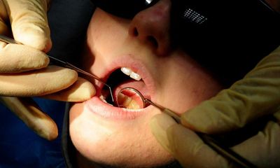 Parts of England have one NHS dentist for thousands of people, data shows