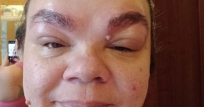 Mum left 'looking like Scar from Lion King' after eyebrow tint goes terribly wrong