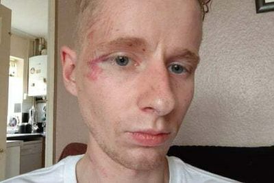 Man details horrific homophobic attack on Golden Jubilee Bridge, near South Bank