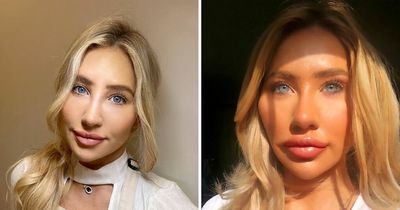 Beautician who spent £5,000 becoming 'Barbie' says she refuses to carry out similar treatments on some women