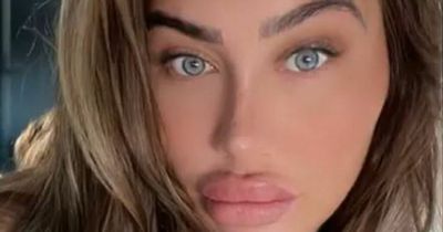 Lauren Goodger shows off plump pout as she gets filler to 'find me again' amid heartache