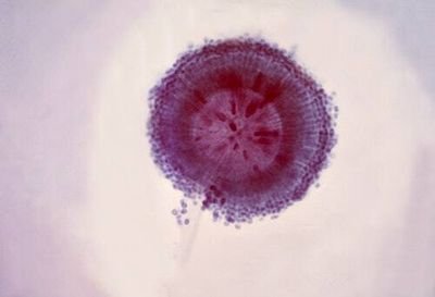 NASA's Moon mission could finally reveal what space does to human DNA