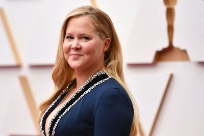 Amy Schumer reveals she has hair pulling disorder Trichotillomania