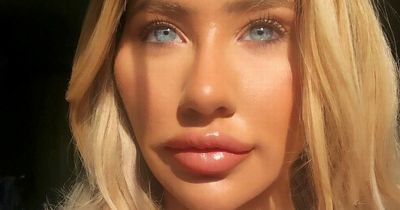 Woman who spent £5k turning herself into 'Barbie' now wants fillers dissolved