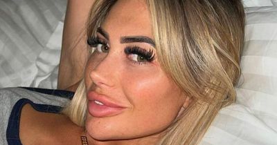 Chloe Ferry says she's 'permanently scarred' as 'botched' fox eye lift 'ruined her life'